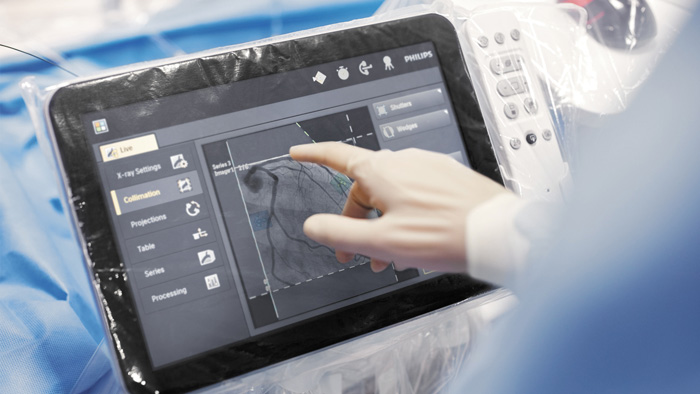 De cardioloog kan via een tablet door het beeldmateriaal navigeren. Foto: Philips Healthcare
